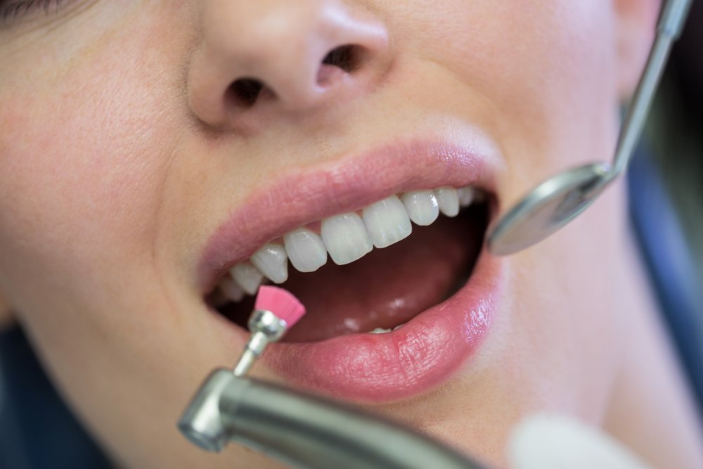 tooth cleaning