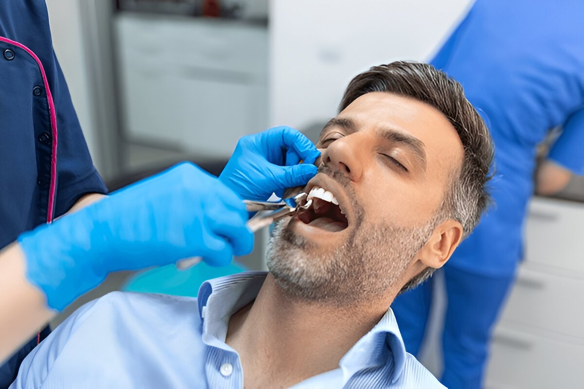 tooth exraction